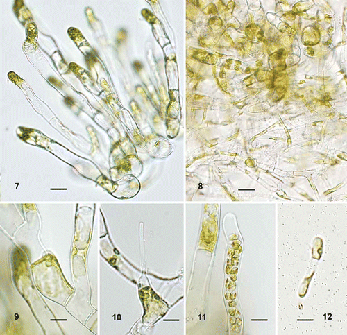 Figs 7–12. Ulvella islandica, morphology of heterotrichous plants in culture. 7. Tuft of broad cylindrical filaments with rounded cells at the base. 8. Basal part of tuft with rhizoid-like filaments. 9. Vegetative cell with a parietal chloroplast and one pyrenoid. 10. Acrochaete-type hair. 11. Cylindrical, apical sporangium. 12. Germling with evacuated spore-wall attached. Scale bars = 20 µm (Figs 7, 8) and 10 µm (Figs 9–12).