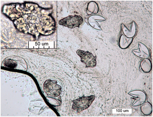 Figure 1. Pulmonary wash from an indigo snake containing larvated and unlarvated eggs, empty egg shells and free moving larvae (inset) consistent with multiple stages of Kiricephalus coarctatus. Bar = 100 µm; Inset bar = 50 µm.