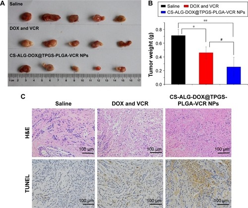 Figure 8 The comparison of in vivo antitumor efficiency between DOX and VCR and CS-ALG-DOX@TPGS-PLGA-VCR NPs. (A) The photographs of tumors tissue. (B) The weight of tumors tissue. (C) Pathological sections of the tumor tissues with H&E stain and TUNEL stain.Notes: Data are presented as mean ± SD (n=5). *P<0.05. **P≤0.01, compared with control. ≤P≤0.05, compared between co-delivery nanoparticles with free DOX and VCR.Abbreviations: CS-ALG-DOX NPs, chitosan-alginate nanoparticles carrying doxorubicin; TPGS-PLGA-VCR NPs, vitamin E D-α-tocopheryl polyethylene glycol 1000 succinate-modified poly(lactic-co-glycolic acid) nanoparticles carrying vincristine; SD, standard deviation; H&E, hematoxylin and eosin; TUNEL, transferase-mediated deoxyuridine triphosphate-biotin nick end labeling; VCR, vincristine; NPs, nanoparticles; DOX, doxorubicin; CS-ALG-DOX@TPGS-PLGA-VCR NPs, CS-ALG-DOX NPs located at TPGS-PLGA-VCR NPs.