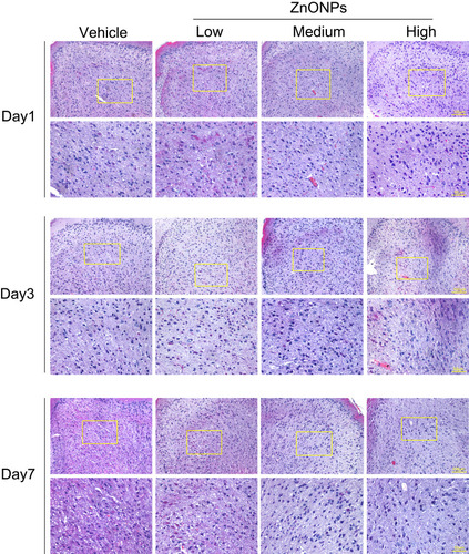 Figure 1 Pulmonary exposure to ZnONPs caused the pathological changes in mouse cerebral cortex. After a single treatment of 3, 6, 12 μg/animal ZnONPs via tracheal instillation, the cerebral cortex tissues were collected at post-exposure days 1, 3 and 7. H&E staining was used to observe the morphological changes in the cerebral cortex (n= 3). Scale bar = 100 μm in original figures or 50 μm in zoom-in figures.