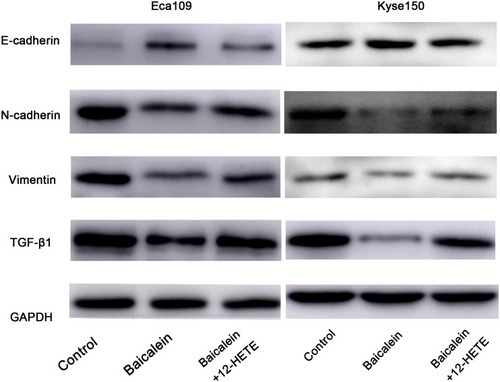 Figure 3 Expression of 12-LOX/12(S)-HETE was associated with TGF-β1 and EMT markers in ESCC cells. The left panel showed that the expression levels of TGF-β1, vimentin and N-cadherin in Eca109 cells were inhibited after treated by Baicalein and that of E-cadherin was increased, and the down-regulated level of EMT was partly relieved when pretreated with 12(S)-HETE; right panel indicates similar results observed in Kyse150 cells.Abbreviations: ESCC, esophageal squamous cell carcinoma; EMT, epithelial-mesenchymal transition.