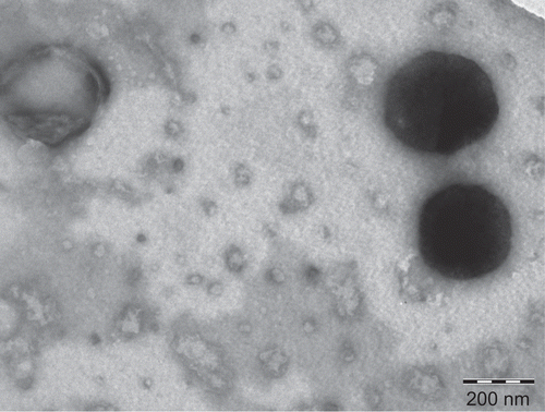 Figure 3.  TEM of liposomes derived from proliposomes (DMPC).