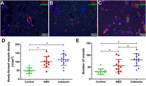 Figure 9 Fluorescence staining of tibial defect sections. Confocal laser-scanning images of αSMA and CD31 staining for bone defects in control (n=10) (A), NBD (n=11) (B), and cefazolin (n=12) (C) groups after 4 weeks. With DAPI, nucleus are counterstained blue. At 4 weeks after intervention, data of neovascularization and physiologically appropriate blood-vessel circumference were normalized to the tissue area (the number of blood vessels/mm2) (D and E). *p<0.05. All samples of animals were examined.