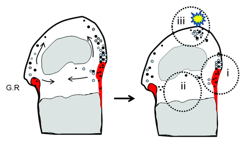 Figure 2. Location and potential functions of CCPs in epiphyseal cartilage Diagrams showing the location of perichondrial groove of Ranvier (G.R) (shaded in red) in the knee joint. CCPs and their differentiated progeny are denoted by dots of black and gray color, respectively. Note that CCPs reside primarily in the groove of Ranvier (i, black), but they can migrate toward, and live in, epiphyseal (ii) and articular cartilage (iii). In these alternative niches, they could either live quiescently (black) or undergo chondrocytic differentiation (gray) and replenish cartilage. We hypothesize that under physiological conditions, CCPs might be required for epiphyseal cartilage development and homeostasis. During cartilage injury (such as osteoarthritis and trauma) or disease conditions (mutations, etc.), these cells respond to pathogenic insults and start to expand to repair cartilage damage or cause tumorigenesis.