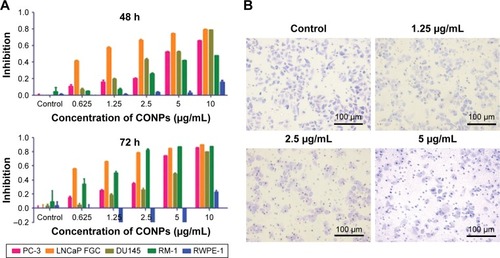 Figure 1 Cytotoxicity and invasion inhibition effects of CONPs.Notes: (A) Differential cytotoxicity of CONPs in castration-resistant prostate cancer cells (PC-3, DU145, RM-1), castration-sensitive prostate cancer cells (LNCaP FGC), and normal cells (RWPE-1) as detected by the CCK8 assay. Prostate cancer cell lines are more sensitive compared with normal prostate epithelial cells. Cells were treated with CONPs for 48 h and 72 h. (B) Effects of CONPs on the invasion of PC-3 cells. The number of migrating PC-3 cells was obviously decreased after treatment with CONPs for 48 h in a dose-dependent manner. Magnification 100×.Abbreviation: CONPs, cuprous oxide nanoparticles.