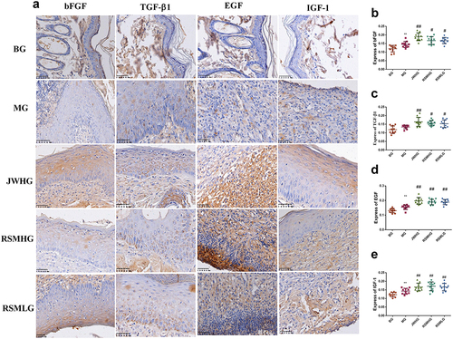 Figure 5 Effect on protein expression of growth factor. (a) Immunohistochemistry pictures (×400). (b–e) Protein expression of growth factor. **P < 0.01 vs BG group. ##P < 0.01, #P < 0.05 vs MG group.