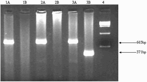 Figure 2. δβ-thalassemia break point B (3′ deletion). It was detected on 2% agarose gel. Explanation of the lanes is as follows; Lane 1AB and 2AB: Wild; Lane 3AB: Heterozygous; Lane 4: 100 bp ladder.