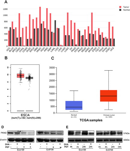 Figure 3. PKM2 is overexpression in oesophageal cancer tissue and DHA enhances PDT sensitivity by inhibiting PKM2. (A)DNA copy number of PKM in the different types of cancer was analysed using GEPIA database. (B) DNA copy number PKM in ESCC was analysed using TCGA. (C) DNA copy number of PKM2 in ESCC was analysed using Oncomine. (D) Western blot analysis for PKM2 expression level in four groups. β-actin was used as an internal control. (E) Western blot analysis for PKM2 expression level in post-PDT 4h alone group, post-PDT 4h + DHA group, post-PDT 24h alone group, post-PDT 24h + DHA group. β-actin was used as an internal control.
