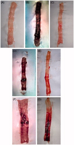 Figure 3. Effects of APME and APAE on macroscopic observation of the colon. The colon from NC rats (A) exhibited normal morphology of colon while the colon from EC rats (B) showed ulceration and inflammation. The colons from PRDS (4 mg/kg) (C), APME (250 and 500 mg/kg) (D and E, respectively), APAE (250 and 500 mg/kg), (F and G, respectively) showed a lesser degree of mucosal damage, ulceration and inflammation compared to B (EC group).