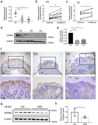 Figure 7. GPR65 is decreased in inflamed mucosa from patients with active IBD and DSS-induced colitis mice. colonic IECs were isolated to extract total RNA and protein. Expression levels of GPR65 were determined by qRT-PCR and Western blot, respectively. (a) relative mRNA expression level of GPR65 in freshly isolated IECs from inflamed sites of patients with CD and UC and relatively normal sites of patients with colon cancer as controls. (b, c) relative mRNA expression levels of GPR65 in paired inflamed and non-affected IECs from patients with CD and UC. (d, e) immunoblotting analysis of GPR65 in inflamed IECs from CD and UC patients and relatively normal IECs from patients with colon cancer. (f) representative sections were obtained from normal colonic mucosa of healthy controls (the left panel) and inflamed colonic mucosa of patients with active CD (the middle panel) or active UC (the right panel), and then stained for GPR65 by immunohistochemistry. Scale bars, 200 μm (inset, 100 μm). (g, h) colonic IECs were isolated from DSS-induced colitis mice and control mice, respectively, and the protein levels of GPR65 were determined by Western blot with β-actin as a reference. *p < 0.05, **p < 0.01, ***p < 0.001. Data are representative of three independent experiments.