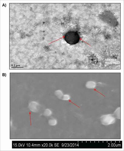 Figure 2. Characterization of mRNA loaded liposomes with respect to shape and size A) mRNA loaded liposomes were characterized with respect to shape and size by Scanning Electron Microscopy (SEM) technique, arrows indicate the formulated (mRNA loaded) liposomes, and B) High resolution negative staining Transmission electron Microscopy (TEM) technique was used to investigate the morphology of liposomes produced by thin film method. At the same magnification of micrograph results, the lamelarity of prepared liposomes is seen different.