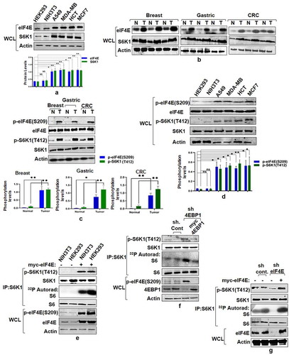 Figure 1. eIF4E governs S6K1 activation state. (a and b) Expression pattern of eIF4E and S6K1 in cancer cells and tissues. Breast cancer (MCF7, MDA-MB28), Lung Cancer (A549) Colon Cancer (HCT) cells along with non-transformed HEK293, NIH3T3 (a) or representatives from Breast, Gastric, Colorectal cancer tissues (represented as T) along with their adjacent normal tissues (represented as N) (b) were harvested and analyzed by immunoblots using indicated antibodies. Quantitation represents the average of three independent experimental series normalized to actin control. Error bars denote SEM. p value denoted as * indicates P < 0.05 and ** as P < 0.01. (c and d) Phosphorylation levels of eIF4E and S6K1 in cancer tissues and Cell lines. The lysates of cell lines and tissues described in A and B, were analyzed by immunoblot as shown. To ensure that increase in the phosphorylation levels is not due to increased total protein levels in cancer samples, total protein load was optimized to bring eIF4E and S6K1 protein levels in cancer samples at par with their corresponding control samples. Unequal loading pattern is seen due to this optimization. Quantitation showing eIF4e and S6K1 phosphorylation levels represents average result of three independent experimental series normalized to their respective protein content. Error bars denote SEM. p value denoted as * indicates P < 0.05 and ** as P < 0.01. (e-g) eIF4E abundance enhances S6K1 activation. NIH3T3, HEK293 cells transfected with myc-eIF4E (e) or HEK293 cells infected with 4EBP1 shRNA (f) or eIF4E shRNA (g) were each grown in three 90 mm culture dishes. The lysate from each set was pooled such as to increase the levels of S6K1 in each lysate. The lysates were subjected to endogenous S6K1 IP to monitor S6K1 activity. S6K1 kinase activity was monitored using GST-S6 as a substrate. Immunoblots represent levels of indicated proteins