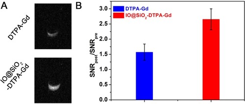 Figure 6 Cellular level imaging. (A) T1-weighted MR images of cells incubated with DTPA-Gd and IO@SiO2-DTPA-Gd NPs. (B) Signal-to-noise ratio changes of T1-weighted images of Hela cells incubated with DTPA-Gd and IO@SiO2-DTPA-Gd NPs.Abbreviations: Gd, gadolinium; IO, iron oxide, NPs, nanoparticles.