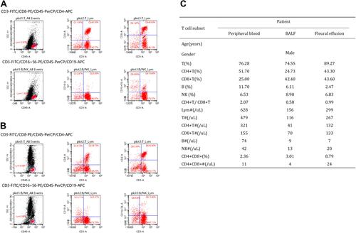 Figure 2 The characteristics of T cell subset in peripheral blood, BALF and pleural effusion of COVID-19 patient. (A) The percentage of lymphocytes (T%), B cells (B%) or NK cells (NK%) in pleural effusion. (B) The percentage of lymphocytes (T%), B cells (B%) or NK cells (NK%) in BALF. (C) The characteristics of T cell subset in peripheral blood, BALF and pleural effusion.