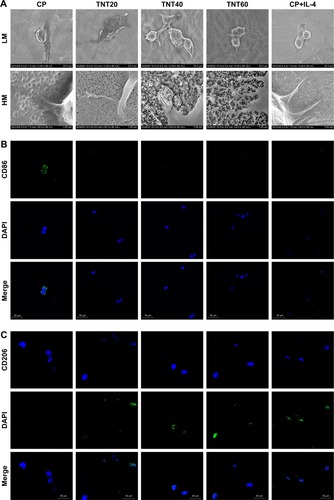 Figure 2 Macrophage behavior on nanotubular TiO2 surface.Notes: (A) SEM of macrophages incubated for 3 days on different samples (CP, TNT20, TNT40, and TNT60). (B) Confocal detection of the M1 marker protein CD86 after 48 hours of culture. (C) Confocal detection of the M2 marker protein CD206 after 48 hours of culture. (D) Flow cytometry for detection of the membrane surface proteins CD86 and CD206. (E) Analysis of flow cytometry results for CD86-positive rates. (F) Analysis of flow cytometry results for CD206-positive rates. (G) Real-time PCR detection of macrophage polarization and inflammation-related gene expression after 24 hours of culture. (H) Chemiluminescence detection of inflammatory factors in supernatants. (I) Western blot analysis of inflammation-related proteins on CP, TNT20, TNT40, and TNT60 after 20 minutes of culture. (J) Analysis of phospho-IKB-α activity using the images shown in I. (K) ELISA of macrophage-secreted VEGF in supernatants after 72 hours of culture. (L) VEGF gene expression levels in macrophages after 24 hours of culture. Results are presented as mean ± SD (N=3). *P<0.05; **P<0.01.Abbreviations: CP, commercially pure Ti; TNT20, TNT40, and TNT60, TiO2 nanotubes produced by different voltages; VEGF, vascular endothelial growth factor; SEM, scanning electron microscopy; LM, low magnification; HM, high magnification; PCR, polymerase chain reaction.