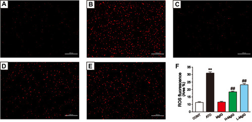 Figure 5 Effects of MgIG on the levels of ROS. Fluorescence images of different groups (A), CONT group; (B), ATO group; (C), MgIG alone treated group; (D), H-MgIG group; (E), L-MgIG group) and the ratio graph (F) about ROS are presented. Scale bar = 100 µm (200 ×). The values were presented as the mean ± SEM. ** P < 0.01 vs CONT; ##P < 0.01 vs the ATO group, n = 6.