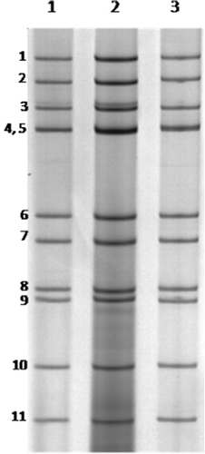Figure 1. PAGE migration profile of RVD (5:2:2:2) observed in three representative study samples (lanes 1 to 3).
