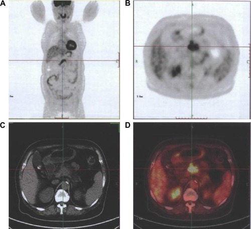 Figure 2 Images of a female participant, 66 years.