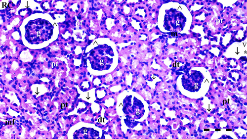 Figure 11 Representative light microscopy of kidney tissue from the DIR-S group. Scale bar 50 µm, H&Ex100.