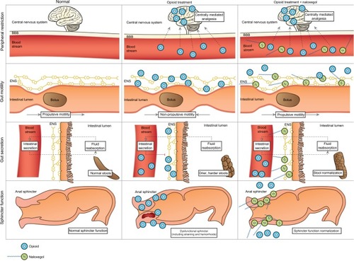 Figure 4 Pharmacological principle of naloxegol under normal conditions (left column), during opioid treatment (middle) and opioid and naloxegol treatment (right).