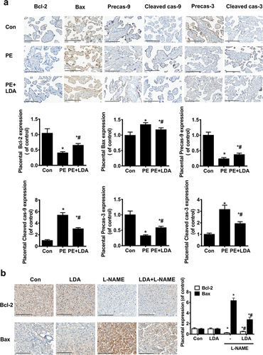 Figure 3. LDA inhibits mitochondrial apoptosis in PE placenta or in the L-NAME-induced PE rat model. a. Expression of Bcl-2, Bax, Precaspase-9, Precaspase-3, cleaved caspase-9, and cleaved caspase-3 in human placental specimens by immunohistochemistry; brown-yellow particles are shown with a staining intensity score of 0 (none), 1 (weak), 2 (medium), or 3 (strong). Scale bar = 200 µm, the number of positive cells was counted for statistical analysis (n = 14-16, *P < 0.05 vs. con, #P < 0.05 vs. PE); b. The expression of Bcl-2 and Bax was detected in rat model placental specimens by immunohistochemical methods. Scale bar = 200 µm, the number of positive cells was counted for statistical analysis (n = 5, *P < 0.05 vs. con, #P < 0.05 vs. L-NAME).