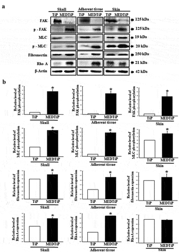 Figure 11. Expression of FAK/MLC2 signaling pathway members in MEDTiP-implanted calvarial defect rats. Expression levels of six proteins in three different tissue types were determined using an imaging densitometer. The level of each protein is presented relative to the intensity of actin. Two to three rats per group were used to prepare tissue homogenates, and western blot analysis was performed in duplicate for each sample. Data are reported as the mean ± SD. *, p < 0.05 relative to the TiP-implanted group. Abbreviations: TiP, Titanium plate, MEDTiP, MED-coated titanium plate.