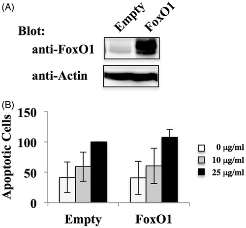 Figure 4. Effect of FoxO1 over-expression on MT-2CA1 cells. (A) Extracts of MT-CA1Empty and MT-2CA1FoxO1 cells were analyzed by immunoblotting using anti-FoxO1 and anti-actin antibodies. Data shown are representative of three independent experiments. (B) MT-CA1Empty and MT-2CA1FoxO1 cells were treated with 10 (grey bars) or 25 (black bars) μg/ml chrysotile A for 24 h. Control cells without treatment are shown as open bars. Apoptotic cells were measured using flow cytometry. Values shown are relative to those of apoptotic cells of MT-2Ctrl with 10 (grey bars) and 25 (black bars) μg/ml chrysotile A.
