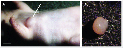 Figure 1. Established Ewing's sarcoma PDOX model. (A) Four weeks after tumor implantation in the space between the pectoral muscle and intercostal muscle, the Ewing's sarcoma PDOX tumors grew in the chest wall (arrow). (B) Resected tumor from the same mouse. Scale bars: 5 mm.