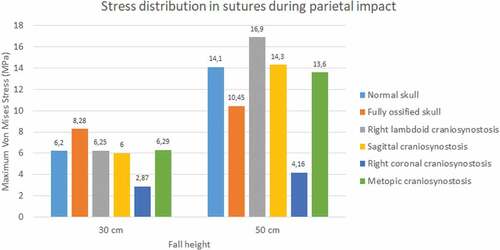 Figure 14. Maximum Von Mises stress in sutures during parietal impact from 30 and 50 cm falls with different degrees of ossification in the sutures