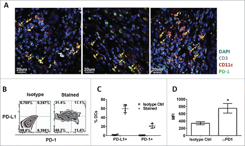 Figure 4. Existence of tumor-infiltrating PD-1+ CD11c+ myeloid cells in cancerous liver tissue of patient and mice. (A) Immunofluorescence (IF) images showing co-localization of PD-1 (green) with either CD11c (red) or CD3 (white). Cell nuclei were stained with DAPI (blue). CD11c+ myeloid cells expressing PD-1 were identified in yellow color (arrow head). Each IF image was captured from cancerous liver tissue from individual HCC patients (N = 3). (B) HIDCs co-express PD-1 and PD-L1 in the spontaneous HCC mouse model. Quadrants were established with reference to the isotype controls. The inset values are the percentage of HIDCs within each quadrant. All HIDCs were gated on GR1-, CD3-, F4/80-, CD11chi, MHC-II+ cells. (C) Percentages of HIDCs which co-express PD-1 or PD-L1. Each data point was derived from individual HCC mice (N = 4). (D) Quantification of PD-1 expression on HIDCs by flow cytometry. Mean fluorescent intensity (MFI) values were determined from individual HCC mice (N = 4). HCC: hepatocellular carcinoma; HIDC: HCC-infiltrating DC. *p < 0.02, unpaired t-test.