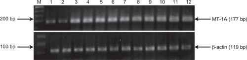 Figure 1 MT-1A gene expression in SM-injured patients and in unexposed control cases. Gene expressions were measured by semiquantitative reverse transcriptase polymerase chain reaction, and were upregulated in SM-injured patients (lanes 3–12). Normal samples (lanes 1 and 2), SM-injured patients samples (lanes 3–13).