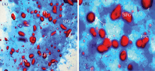 Figure 2. Light photomicrograph of double-dyed meat batter (A: 40×; B: 200×). Figura 2. Microfotografía de luz de la masa de carne doble teñido (A: 40×, B: 200×).