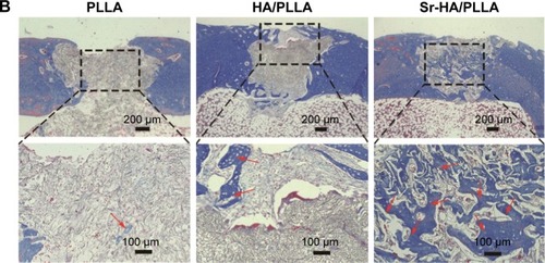 Figure 7 The changes in bone microstructure after implantation of different porous scaffolds.Notes: (A) Microscopic images of H&E-stained tissue sections of femur defects after 5 weeks’ implantation. (B) Masson-stained tissue sections of femur defects after 5 weeks’ implantation (black arrow: new bone, ^: blood vessel, and red arrow: collagen).Abbreviations: H&E, hematoxylin and eosin; PLLA, poly(l-lactic acid); HA/PLLA, hydroxyapatite on porous poly(l-lactic acid); Sr-HA/PLLA, strontium-doped hydroxyapatite on porous poly(l-lactic acid).