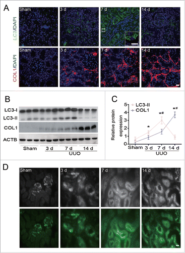 Figure 1. Dynamics of autophagy and COL1 accumulation after UUO. (A) Representative images of immunofluorescence staining for LC3 (green) and COL1 (red) on kidney sections after 3,7, and 14 d of UUO compared with sham-operated C57BL/6 mice. Nuclei are highlighted with DAPI. Insert shows higher magnification images of LC3 puncta. Scale bar: 20 μm and 10 μm (insert). (B) Immunoblot analyses of LC3 and COL1 in the sham-operated and UUO kidneys of C57BL/6 mice. ACTB was used as loading control. (C) Densitometry of LC3-II and COL1 in immunoblots. Data are means ± SEM (n = 6); *, P < 0.01 vs. sham; #, P < 0.05 vs. other groups in UUO. (D) Representative images of LC3-positive dots in the kidney of GFP-Lc3 transgenic mice in different groups as indicated. Fluorescent signals were depicted as black and white in the upper panels. Scale bar: 20 μm.
