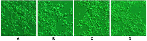 Figure 3 Morphological observation results of HepG2 cells after SMC treatments.