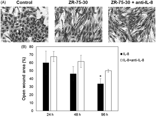 Figure 4. Effect of neutralizing antibody anti-IL-8 on morphology of endothelial cells treated with ZR-75-30 cells secretome. (A) HUVEC treated with control medium, conditioned medium of ZR-75-30 cells and conditioned medium of ZR-75-30 cells plus neutralizing antibody anti IL-8 (0.4 μg/ml). Cells were treated for 24 h and then stained with crystal violet. (B) Positive control to test neutralizing activity of anti-IL-8. Cells were treated with IL-8 (100 ng/ml) and IL-8 plus neutralizing antibody against IL-8 (2 μg/ml) for 24, 48 and 96 h, then migration of MDA-MB-231 cells was evaluated mediating a wound assay. Analysis of the percentage of open wound area was performed with TScratch software. Data are shown as the percentage of open wound area in comparison with IL-8-treated cells. Results are expressed as the mean ± SD from three independent experiments. *p < .05 compared with IL-8-treated cells.