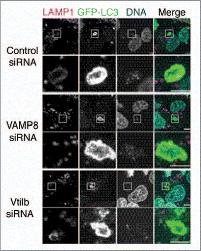 Figure 1 Knockdown of VAMP8 and Vti1b inhibits colocalization of xenophagosomes with lysosomes. HeLa cells expressing GFP-LC3 were transfected with control siRN A, and VAMP8 and Vti1b siRN As. Following infection with GAS, the cells were fixed and incubated with anti-LAMP1 antibodies and observed with a confocal microscope. Cellular and bacterial DN A were stained with DAPI. LAMP1 failed to colocalize with GFP-LC3 in the SNARE -depleted cells. Boxed regions in the upper panels show magnifications of the lower panels. Bars indicate 5 µm.
