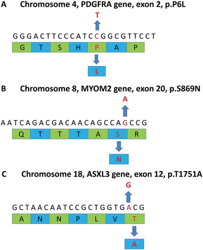 Figure 2. Summary of whole exome sequencing. The upper sequences in each diagram represent gene sequences and lower green and blue strips are amino acid sequences. A The diagram reveals a point mutation (C→T) at p.P6L in exon 2 of the PDGFRA gene. The point mutation is a missense mutation in chromosome 4 which alters its corresponding amino acid (P→L). B The diagram indicates a point mutation (G→A) at p.S869N in exon 20 of the MYOM2 gene. The point mutation is a missense mutation in chromosome 8 that leads to a change in the corresponding amino acid (S→N). C The diagram shows a point mutation (A→G) at p.T1751A in exon 12 of the ASXL3 gene. This is a missense mutation on chromosome 18 causing a substitution of its corresponding amino acid (T→A).