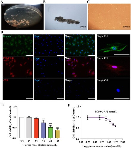 Figure 4. Successful primary culture of cochlear stria vascularis pericytes and optimal high glucose intervention concentration. A: Dissected cochlear stria vascularis; B: Representative image of stria vascularis pericytes on the third day of culture, Scale bar = 50 μm; C: Representative image of cochlear pericytes on the fourteenth day of culture, Scale bar = 100 μm; D: Identification of stria vascularis pericytes, Scale bar = 50 μm; E: Statistical results of the CCK8 assay for screening the appropriate high glucose intervention concentration, n = 6, One-way Anova with Turkey’s post-hoc test, ***P < 0.001 vs Control; F:The effect of glucose on the survival rate of stria vascularis pericytes and the EC50 of glucose for these cells.