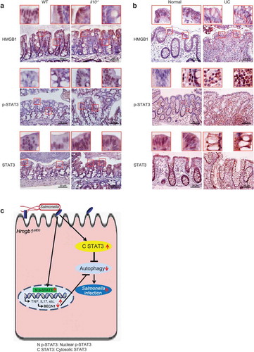 Figure 10. Altered HMGB1 and STAT3 expression was observed in an experimental mouse model of colitis and in ulcerative colitis (UC) patients. (a) Intestinal HMGB1, p-STAT3 and STAT3 staining in an experimental mouse model of colitis (il10-/- mice). HMGB1 staining revealed translocation from the nucleus to the cell membrane in il10-/- mice exhibiting hallmarks of colitis. Levels of intestinal p-STA3 staining were higher in il10-/- mice with symptoms of colitis. Intestinal STAT3 staining revealed translocation from the nucleus to the cell membrane in il10-/- mice with symptoms of colitis. Data are from a single experiment and are representative of 6 mice per group. (b) Intestinal HMGB1, p-STAT3 and STAT3 staining in UC patients. Intestinal HMGB1 staining revealed translocation from the nucleus to the cell membrane in inflamed colon tissues from UC patients. Intestinal p-STA3 staining was higher in inflamed colon tissues from UC patients. Intestinal STAT3 staining revealed translocation from the nucleus to the cell membrane in inflamed colon tissues from UC patients. Images are representative of experiments that we carried out in triplicate; normal, n = 10; UC, n = 16. (c) A working model for intestinal epithelial HMGB1 in bacterial infection. Deletion of Hmgb1 in intestinal epithelial cells abolished the HMGB1-STAT3 binding. Lacking colonic epithelial HMGB1 led to redistribution of STAT3 post bacterial infection. Then, increased p-STAT3 and extranuclear STAT3 reduced autophagic responses, increased inflammation, and enhanced bacterial invasion. These changes could be restored by inhibiting the STAT3 activity.