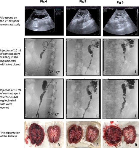 Figure 8 Post-operative investigations.