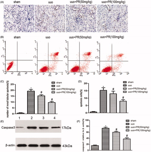 Figure 4. Effects of puerarin treatment in cell apoptosis after UUO in mouse. (A) Representative photomicrographs showing cell apoptosis in TUNEL staining in the four groups: sham, UUO, UUO +50 mg/kg PR, and UUO +100 mg/kg PR. (B) Representative photomicrographs showing cell apoptosis FCM in the four groups: sham, UUO, UUO +50 mg/kg PR, and UUO +100 mg/kg PR. (C and D) Semiquantitative analysis of apoptosis rate. (E) Representative Western blot gels for caspase-3. Numbers 1, 2, 3, and 4 correspond to sham, UUO, UUO +50 mg/kg PR, and UUO +100 mg/kg PR groups, respectively. (F) Semiquantitative analysis of caspase-3. *p < .05 compared with the sham group; #p < 0.05 compared with the UUO group.