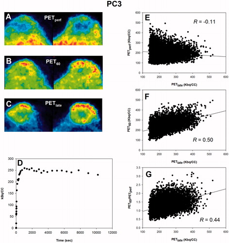 Figure 4. Scatterplot analysis for PC3. (A–C): PET images in two dimensions showing the time-dependent development of the intratumoral FAZA distribution in a PC3 back tumor. (D): whole-tumor TAC showing the distribution over time in average tumor tracer signal. (E): voxel-by-voxel correlation between late (PETlate: 160–180 min PI) and early (PETperf: 0–10 min PI) FAZA signal. (F): voxel-by-voxel correlation between PETlate and FAZA signal 60 min PI (PET60). (G): voxel-by-voxel correlation between PETlate and PET60 normalized to a perfusion surrogate measure derived as the average signal from 0 to 10 min PI (PET60/PETperf). FAZA: 18F-azomycin arabinoside; PET: positron emission tomography; PI: post-injection; TAC: time–activity curve.