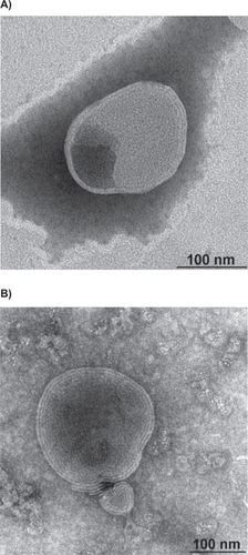 Figure 1 Transmission electron micrographs of A) uncoated liposomes and B) CH-coated liposomes. Bar is 100 nm.
