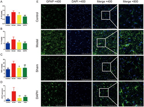 Figure 2. Effects of daphnetin on the sciatic nerve and spinal cord astrocytes in CCI rats. (A–C) ELISA kits to detect the expression of IL-1β, IL-6, and TNF-α in sciatic nerve (n = 6). (D) Expression of GFAP in rat spinal cord in immunofluorescence staining (n = 3). (E) Immunofluorescence staining of rat spinal cord astrocyte marker GFAP (n = 3). *p < .05, **p < .01 vs. Model group.