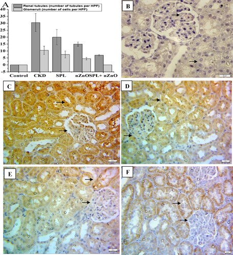 Figure 5. Immunohistopathological examination for TGF-β1 expression in kidney tissues. (A) The score of TGF-β1 in all studied groups, (B) negative expression for TGF-β1 (control group, 400×), (C) marked cytoplasmic expression for TGF-β1 in both renal tubules and glomeruli (CKD group, 200×), (D) moderate expression of TGF-β1 in SPL group (200×), (E) mild expression of TGF-β1 in ZnO-NPs group (200×), and (F) mild expression in SPL + ZnO-NPs group (200×). a: significant difference versus control, b: significant versus CKD, c: significant versus SPL, d: significant versus ZnO-NPs at p < 0.05.