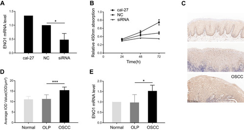 Figure 1 ENO1 facilitating cell proliferation was increased in oral squamous cell carcinoma (OSCC).