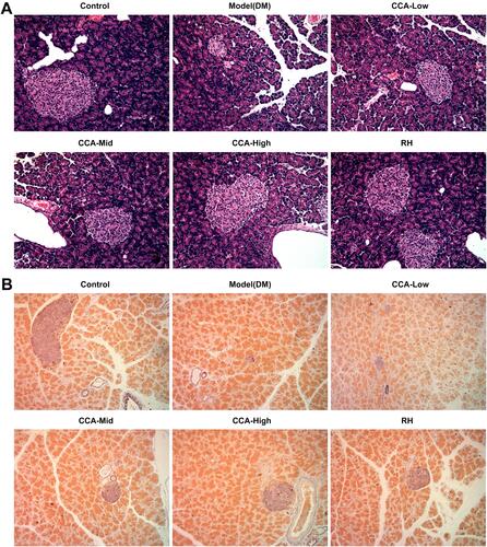 Figure 2 The effects of CCA on pancreatic pathology and islet cell numbers in vivo. The pancreatic pathology and islet cell numbers evaluated by hematein–eosin HE staining (A) and aldehyde fuchsin staining assay (B) respectively in the different groups.