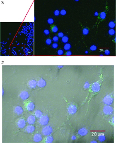 Figure 4. Confocal microscopy of GDEN uptake by RAW 264.7 cells during 6 h incubation period, magnification of 400×.Goldenberry-derived exosome-like nanoparticles (GDEN) (green) was observed around the nucleus (blue) (A), further observation with bright-field overlay confirmed the internalization of GDEN into the cell cytoplasm (B).