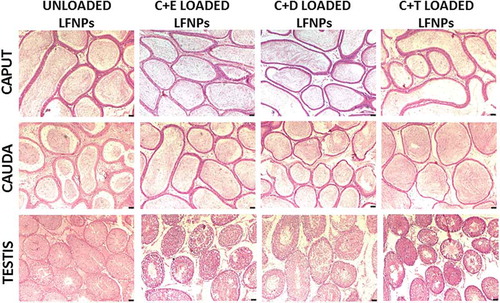 Figure 2. Histopathology of reproductive tissues after oral administration of DL-LFNPs. Male wistar rats were administered 5 mg/Kg of DL-LFNPs for 3 weeks. Following treatment, caput, cauda and testis were collected, sectioned and stained with hematoxylin and eosin.